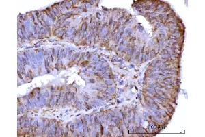 IHC analysis of RPS25 using anti-RPS25 antibody (ABIN7601567).