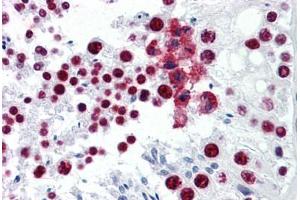 Human Testis: Formalin-Fixed, Paraffin-Embedded (FFPE) (CDKL1 抗体  (AA 259-358))