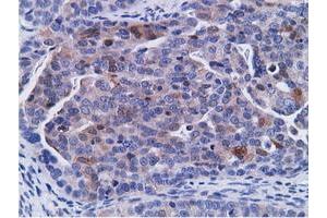 Immunohistochemical staining of paraffin-embedded Human Kidney tissue using anti-CD80 mouse monoclonal antibody. (CD80 抗体)