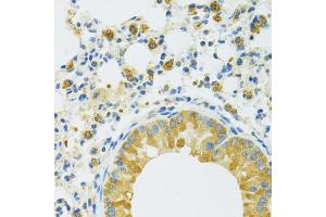 Immunohistochemistry of paraffin-embedded mouse lung using SLC37A4 antibody. (SLC37A4 抗体)