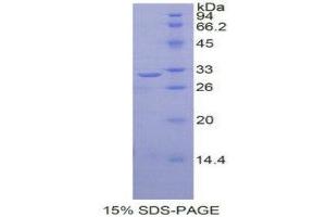 SDS-PAGE (SDS) image for V-Rel Reticuloendotheliosis Viral Oncogene Homolog B (RELB) (AA 248-492) protein (His tag) (ABIN1877490) (RELB Protein (AA 248-492) (His tag))