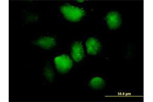 Immunofluorescence of purified MaxPab antibody to ZNF74 on HeLa cell. (ZNF74 抗体  (AA 1-644))