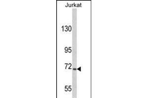 Western blot analysis of hUSP19- (ABIN388908 and ABIN2839191) in Jurkat cell line lysates (35 μg/lane). (USP19 抗体  (C-Term))