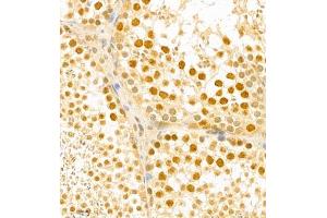 Immunohistochemistry (Paraffin-embedded Sections) (IHC (p)) image for anti-Bromodomain PHD Finger Transcription Factor (BPTF) antibody (ABIN7073234)