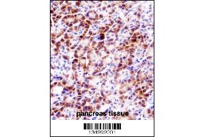 PRSS27 Antibody immunohistochemistry analysis in formalin fixed and paraffin embedded human pancreas tissue followed by peroxidase conjugation of the secondary antibody and DAB staining. (PRSS27 抗体  (C-Term))