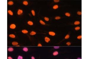 Immunofluorescence analysis of U-2 OS cells using ZBED1 Polyclonal Antibody at dilution of 1:100. (ZBED1 抗体)