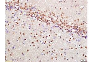 Paraformaldehyde-fixed, paraffin embedded rat brain, Antigen retrieval by boiling in sodium citrate buffer (pH6) for 15min, Block endogenous peroxidase by 3% hydrogen peroxide for 30 minutes, Blocking buffer (normal goat serum) at 37°C for 20min, Antibody incubation with mTOR (Ser2448) Polyclonal Antibody, Unconjugated  at 1:200 overnight at 4°C, followed by a conjugated secondary and DAB staining. (MTOR 抗体  (pSer2448))