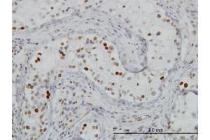 Immunoperoxidase of monoclonal antibody to BRD3 on formalin-fixed paraffin-embedded human testis. (BRD3 抗体  (AA 418-556))