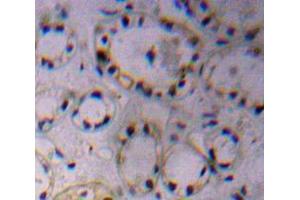 Used in DAB staining on fromalin fixed paraffin-embedded Kidney tissue (ADAM17 抗体  (AA 226-473))