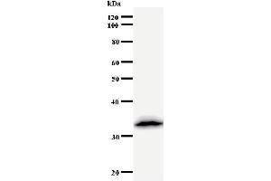 Western Blotting (WB) image for anti-Deoxycytidine Kinase (DCK) antibody (ABIN931037) (DCK 抗体)