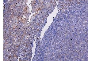 IHC analysis of CXCR2 using anti-CXCR2 antibody (ABIN7601315).