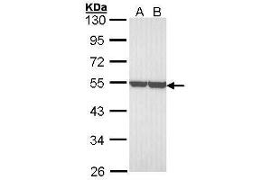 WB Image Sample (30 ug of whole cell lysate) A: A431 , B: H1299 10% SDS PAGE antibody diluted at 1:3000 (ENO1 抗体)