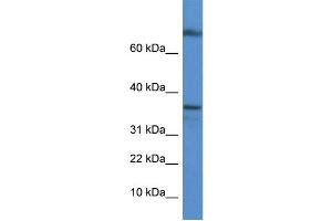 WB Suggested Anti-Tcea1 Antibody   Titration: 1. (TCEA1 抗体  (C-Term))