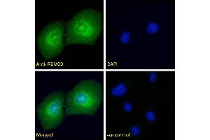 ABIN5937391 Immunofluorescence analysis of paraformaldehyde fixed U2OS cells, permeabilised with 0. (RBM20 抗体  (AA 717-727))