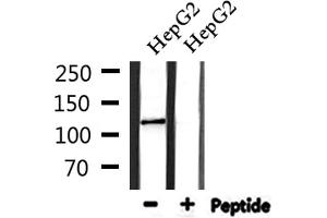 Western Blotting (WB) image for anti-Collagen, Type I, alpha 2 (COL1A2) (N-Term) antibody (ABIN6258438)