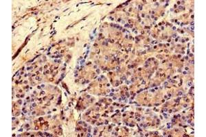 Immunohistochemistry of paraffin-embedded human pancreatic tissue using ABIN7167725 at dilution of 1:100 (RCOR3 抗体  (AA 1-300))