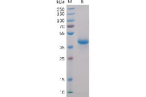 SDS-PAGE (SDS) image for Tumor Necrosis Factor Receptor Superfamily, Member 17 (TNFRSF17) (AA 1-54) protein (Fc-His Tag) (ABIN6961074)