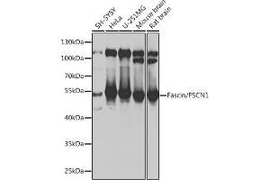 Western blot analysis of extracts of various cell lines, using Fascin/Fascin/FSCN1 antibody (ABIN6131667, ABIN6140779, ABIN6140780 and ABIN6217317) at 1:1000 dilution. (Fascin 抗体  (AA 260-380))