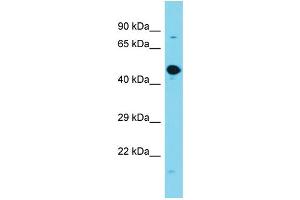 Host: Rabbit Target Name: GPATCH2L Sample Type: Fetal Brain lysates Antibody Dilution: 1. (GPATCH2L 抗体  (Middle Region))