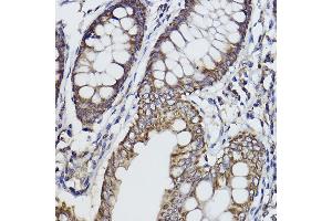 Immunohistochemistry of paraffin-embedded human colon using Fukutin Rabbit mAb (ABIN7267275) at dilution of 1:100 (40x lens). (Fukutin 抗体)