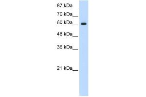 Western Blot showing HIF3A antibody used at a concentration of 1-2 ug/ml to detect its target protein. (HIF3A 抗体  (C-Term))