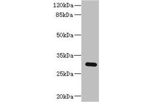Western blot All lanes: BPGM antibody at 2. (BPGM 抗体  (AA 1-259))