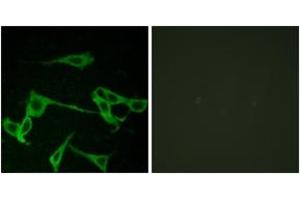 Immunofluorescence analysis of LOVO cells, using HRH2 Antibody. (HRH2 抗体  (AA 131-180))