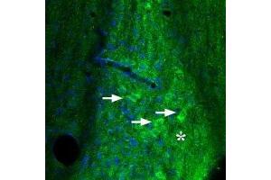 Expression of Adenosine A2A Receptor in mouse diagonal band - Immunohistochemical staining of mouse diagonal band using Anti-Adenosine A2A Receptor Antibody (ABIN7042883, ABIN7043888 and ABIN7043889). (Adenosine A2a Receptor 抗体  (AA 201-215))