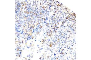 Immunohistochemistry (IHC) image for anti-Bruton Agammaglobulinemia tyrosine Kinase (BTK) (AA 30-240) antibody (ABIN3022171)