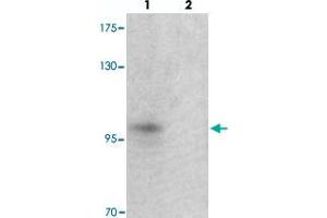 Western blot analysis of TSHZ2 in A-20 cell lysate with TSHZ2 polyclonal antibody  at 1 ug/mL in (lane 1) the absence and (lane 2) the presence of blocking peptide. (TSHZ2 抗体  (N-Term))
