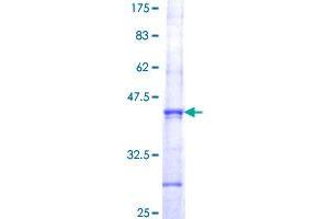 EXOSC9 Protein (AA 124-220) (GST tag)