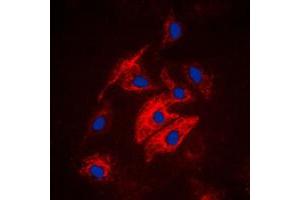 Immunofluorescent analysis of MAST4 staining in HuvEc cells. (MAST4 抗体  (N-Term))