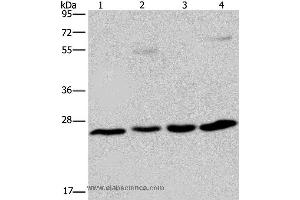 Western blot analysis of A549 cell and human hepatocellular carcinoma, mouse liver tissue and HT-29 cell, using ETHE1 Polyclonal Antibody at dilution of 1:400 (ETHE1 抗体)