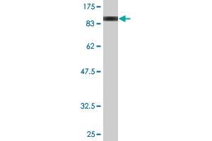 Western Blotting (WB) image for anti-Dystrophin (DMD) (AA 1-635) antibody (ABIN515027)