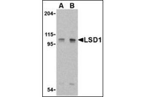 Western blot analysis of LSD1 in P815 cell lysate with this product at (A) 1 and (B) 2 μg/ml. (LSD1 抗体  (Center))