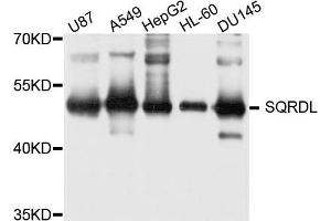 Western blot analysis of extract of various cells, using SQRDL antibody. (SQRDL 抗体)