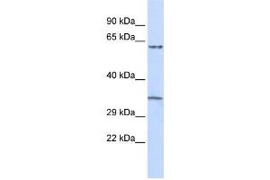 Western Blotting (WB) image for anti-Tripartite Motif Containing 8 (TRIM8) antibody (ABIN2458103) (TRIM8 抗体)