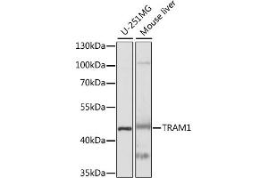 Western blot analysis of extracts of various cell lines, using TR antibody (ABIN7270934) at 1:1000 dilution. (TRAM1 抗体  (AA 305-374))