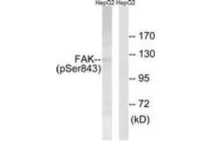Western blot analysis of extracts from HepG2 cells treated with PMA 125ng/ml 20', using FAK (Phospho-Ser843) Antibody. (FAK 抗体  (pSer843))
