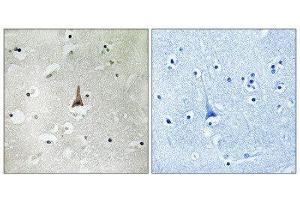 Immunohistochemistry (IHC) image for anti-Low Density Lipoprotein Receptor Related Protein 10 (LRP10) (Internal Region) antibody (ABIN1851502) (LRP10 抗体  (Internal Region))