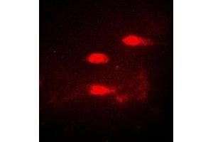 Immunofluorescent analysis of CALCOCO1 staining in A549 cells. (CALCOCO1 抗体)