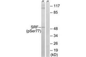 Western blot analysis of extracts from Jurkat cells treated with PMA 125ng/ml 30', using SRF (Phospho-Ser77) Antibody. (SRF 抗体  (pSer77))