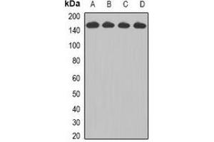 Western blot analysis of CCAR1 expression in Jurkat (A), HepG2 (B), A549 (C), A431 (D) whole cell lysates. (CCAR1 抗体)
