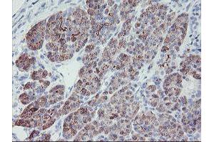 Immunohistochemical staining of paraffin-embedded Human pancreas tissue using anti-PPIL6 mouse monoclonal antibody. (PPIL6 抗体)