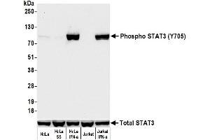 Western Blotting (WB) image for anti-Signal Transducer and Activator of Transcription 3 (Acute-Phase Response Factor) (STAT3) (pTyr705) antibody (ABIN7453986)