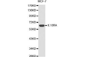 Western blot analysis of extracts of MCF-7 cell lines, using IL10RA antibody. (IL-10RA 抗体  (AA 22-230))