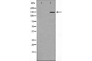 Western blot analysis of extracts of A549 lysate, using NFASC antibody. (NFASC 抗体  (C-Term))