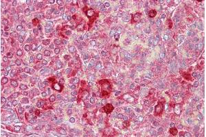 Immunohistochemistry with Spleen tissue at an antibody concentration of 5µg/ml using anti-CUGBP2 antibody (ARP40667_P050) (CELF2 抗体  (N-Term))