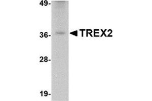 Western blot analysis of TREX2 in rat liver tissue lysate with this product at 2. (TREX2 抗体  (C-Term))