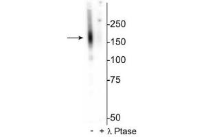 Western blot of mouse kidney lysate showing specific immunolabeling of the ~160 kDa NCC protein phosphorylated at Thr53 in the first lane (-). (SLC12A3 抗体  (pThr53))